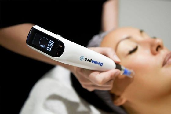 Tratament Microneedling Tratament Microneedling