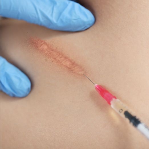 Infiltrații și injecții intralezionale Infiltrații și injecții intralezionale