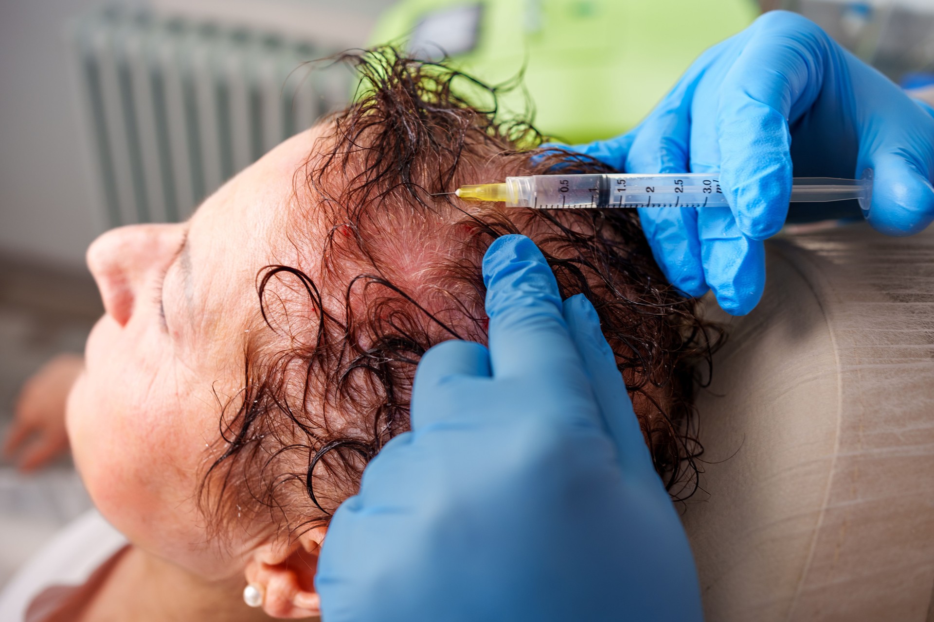 Tratamentul ridurilor, tratamentul căderii părului Tratamentul ridurilor, tratamentul căderii părului